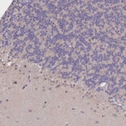 Immunohistochemical staining of human cerebellum shows no positivity in Purkinje cells as expected.