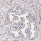 Immunohistochemical staining of human prostate shows no positivity in glandular cells as expected.