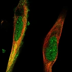 Immunofluorescent staining of human cell line RH-30 shows localization to nucleus, nuclear bodies & cytosol.