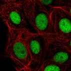 Immunofluorescent staining of human cell line MCF7 shows localization to nucleoplasm.