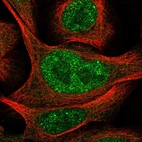 Immunofluorescent staining of human cell line U-2 OS shows localization to nucleoplasm & cytosol.