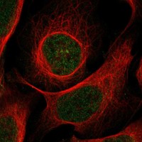 Anti-BTBD11 Antibody