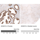 Anti-ADAM10 Antibody