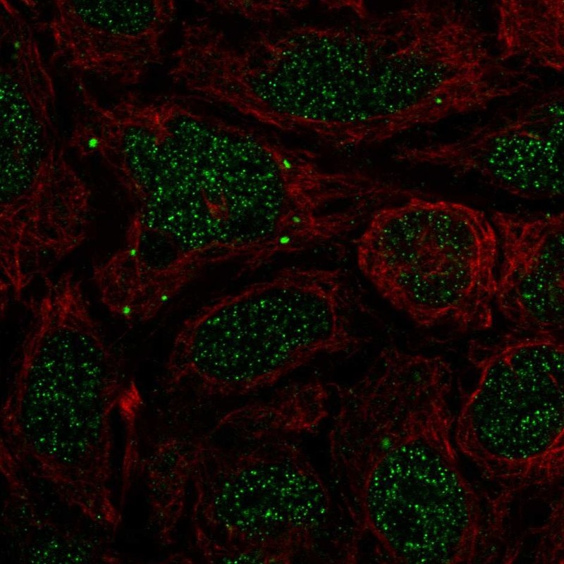 Anti-BMP7 Antibody