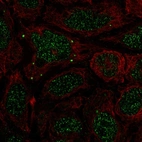 Anti-BMP7 Antibody
