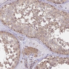 Anti-MIEN1 Antibody