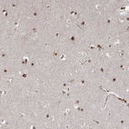 Anti-GTF3C6 Antibody