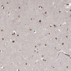 Anti-GTF3C6 Antibody