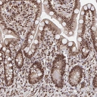 Immunohistochemical staining of human colon shows strong nuclear positivity in glandular cells.