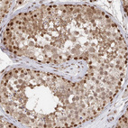 Anti-GTF3C6 Antibody