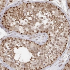 Immunohistochemical staining of human testis shows strong nuclear and cytoplasmic positivity in cells in seminiferous ducts.