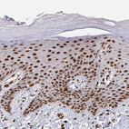 Anti-GTF3C6 Antibody