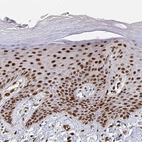 Immunohistochemical staining of human skin shows strong nuclear positivity in squamous epithelial cells.