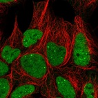 Anti-GTF3C6 Antibody