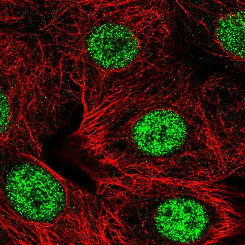 Anti-SMARCD2 Antibody