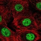 Anti-SMARCD2 Antibody