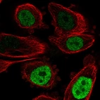 Immunofluorescent staining of human cell line PC-3 shows localization to nucleoplasm.