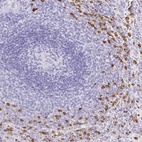 Anti-OR51A7 Antibody