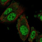 Anti-NFX1 Antibody