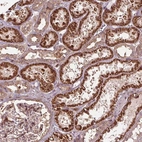 Anti-CEP95 Antibody