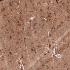 Immunohistochemical staining of human cerebral cortex shows moderate to strong cytoplasmic positivity in neurons.