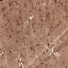 Immunohistochemical staining of human cerebral cortex shows moderate to strong cytoplasmic positivity in neurons.