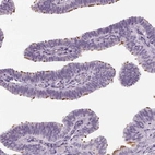 Immunohistochemical staining of human fallopian tube shows high expression.