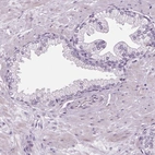 Immunohistochemical staining of human prostate shows low expression as expected.