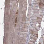 Immunohistochemical staining of human skeletal muscle shows moderate cytoplasmic positivity in myocytes.