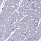 Anti-MYBPH Antibody