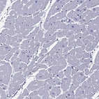 Immunohistochemical staining of human heart muscle shows no cytoplasmic positivity in cardiomyocytes as expected.