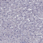 Immunohistochemical staining of human liver shows no cytoplasmic positivity in hepatocytes as expected.
