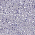 Anti-MYBPH Antibody