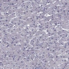 Immunohistochemical staining of human liver shows no cytoplasmic positivity in hepatocytes as expected.