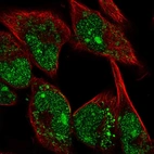 Immunofluorescent staining of human cell line RH-30 shows localization to nucleus, nucleoli & mitochondria.
