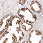 Immunohistochemical staining of human prostate shows strong membranous positivity in glandular cells.