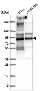 Anti-TACC2 Antibody