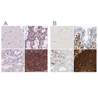Immunohistochemical staining of human cerebral cortex, colon, kidney and lymph node using Anti-ARHGAP25 antibody HPA061395 (A) shows similar protein distribution across tissues to independent antibody HPA035346 (B).