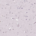 Immunohistochemical staining of human cerebral cortex shows low expression as expected.