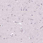 Anti-ARHGAP25 Antibody