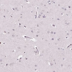 Immunohistochemical staining of human cerebral cortex shows low expression as expected.