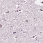 Immunohistochemical staining of human cerebral cortex using Anti-ARHGAP25 antibody HPA061395.