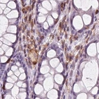 Immunohistochemical staining of human colon using Anti-ARHGAP25 antibody HPA061395.