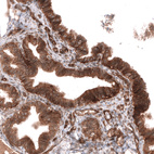 Immunohistochemical staining of human fallopian tube shows strong membranous and cytoplasmic positivity in glandular cells.