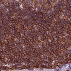Immunohistochemical staining of human lymph node using Anti-ARHGAP25 antibody HPA061395.