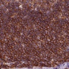 Anti-ARHGAP25 Antibody