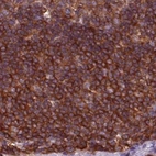 Immunohistochemical staining of human lymph node using Anti-ARHGAP25 antibody HPA061395.