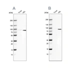 Western blot analysis using Anti-ARHGAP25 antibody HPA061395 (A) shows similar pattern to independent antibody HPA035346 (B).