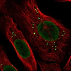 Immunofluorescent staining of human cell line U-2 OS shows localization to nucleoplasm & vesicles.