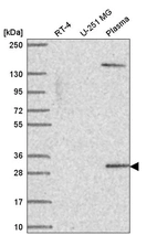 Anti-SCML1 Antibody